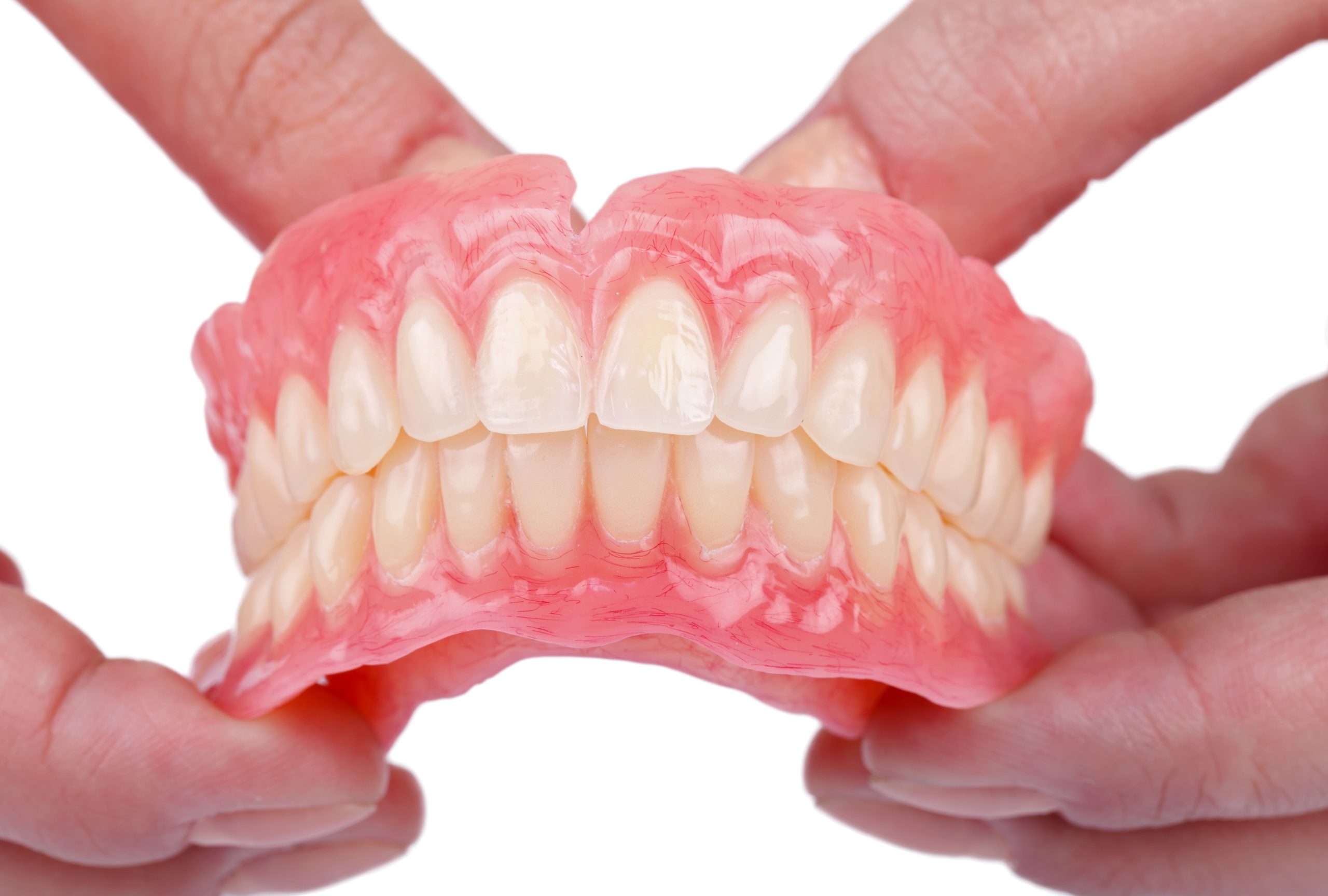 Rehabilitation in case of tooth loss with dental prosthesis