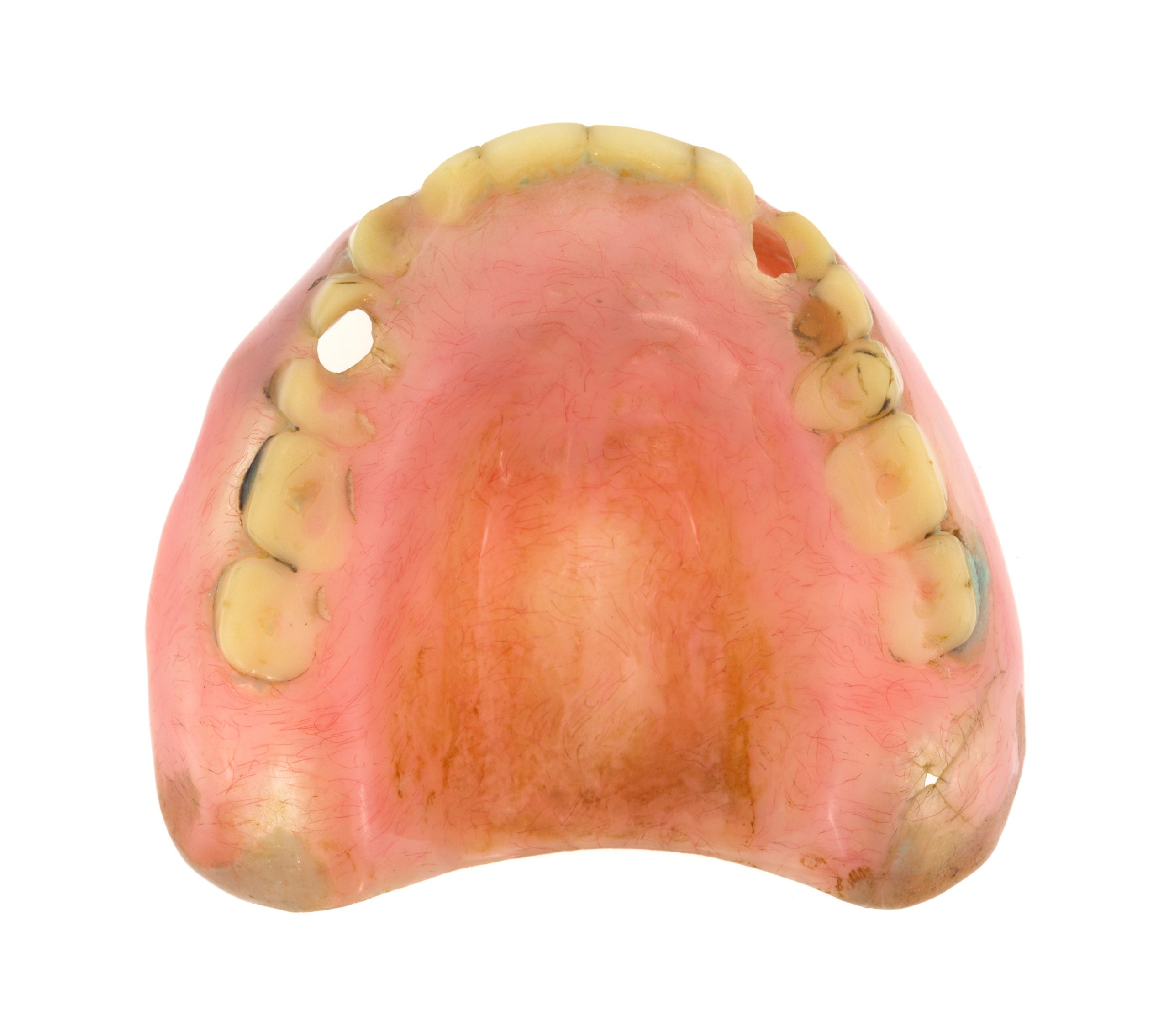 Top view of a very worn upper denture plate on a white background.