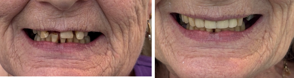 mouth_before_after_pair1